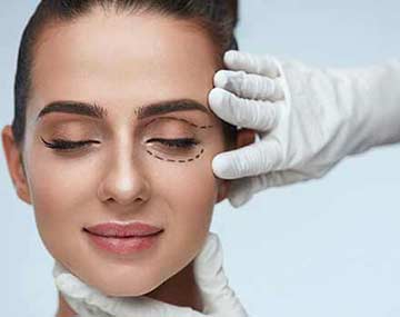 belpharoplasty in iran